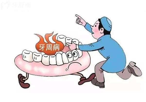 牙周炎怎么治療