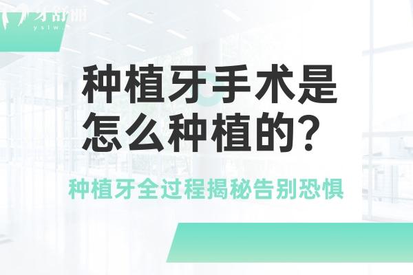 種植牙是怎么種植的