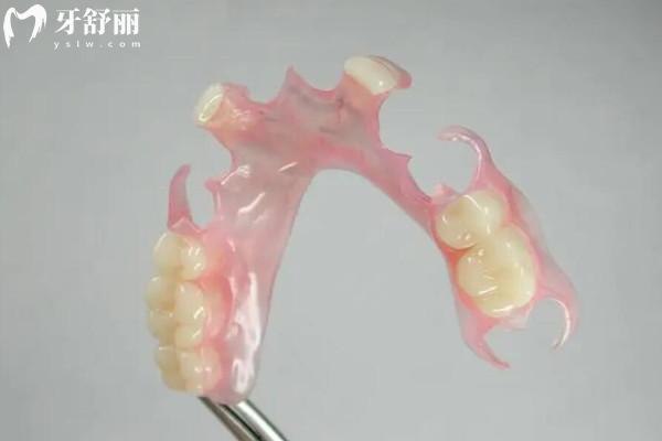 拔牙后多久裝假牙？一分鐘讓你掌握口腔小知識