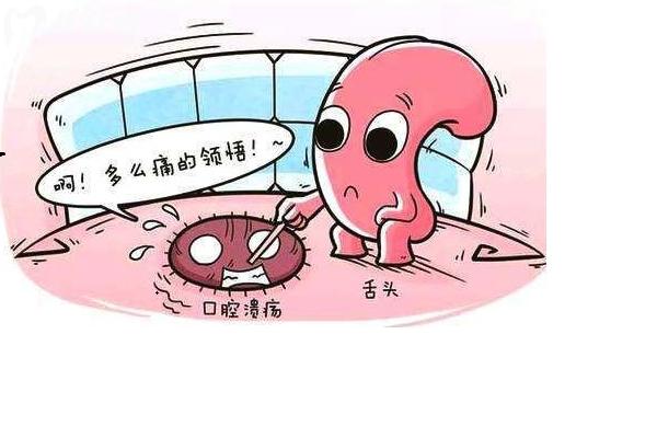 口腔潰瘍