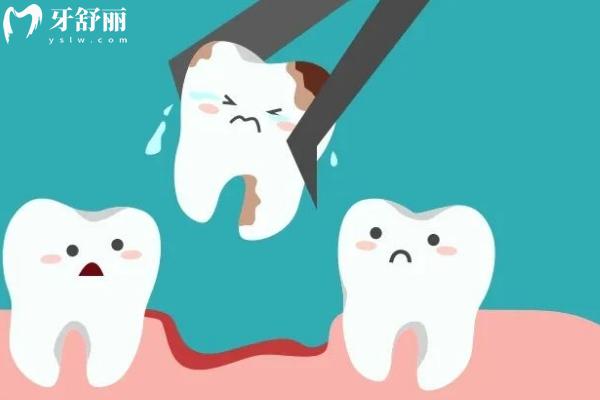 牙齒不是你想拔就拔，任性拔牙后果不堪設想