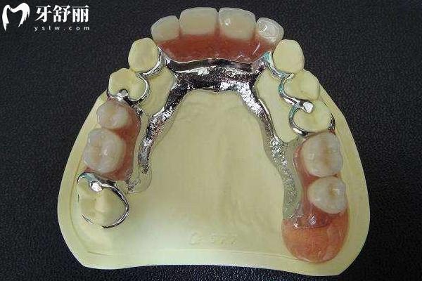 50歲牙齒晃動(dòng)是變老的開始嗎？缺牙了該怎么修復(fù)？