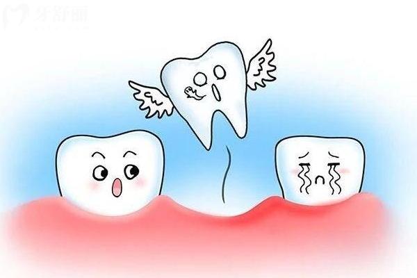 50歲牙齒晃動(dòng)是變老的開始嗎？缺牙了該怎么修復(fù)？