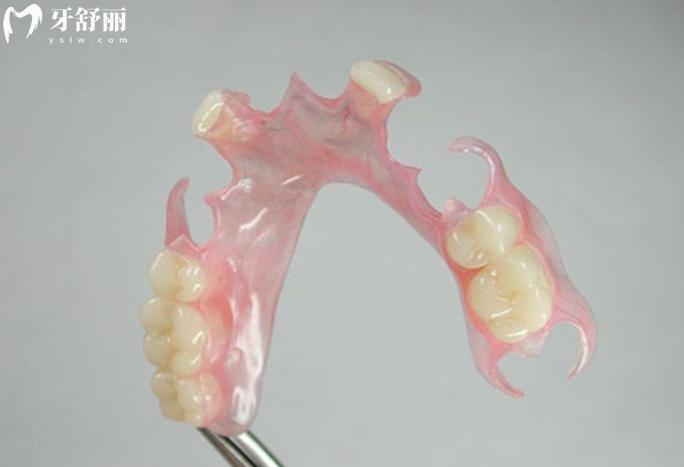 固定假牙好還是活動假牙好