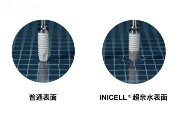 瑞士種植牙品牌排行榜以及價(jià)格