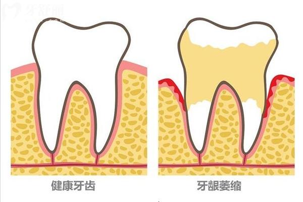 老年人牙齒痛千萬不要”拖“！快來看看家里老人中招了嘛
