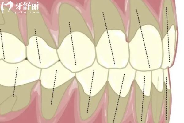 牙齒用手晃有點(diǎn)松動(dòng)正常嗎？會(huì)自己長(zhǎng)好嗎？