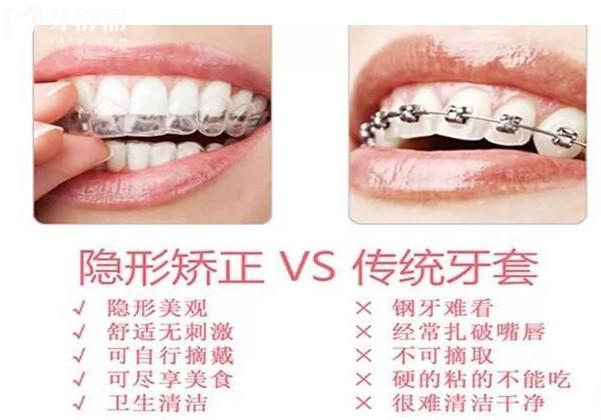 矯正器