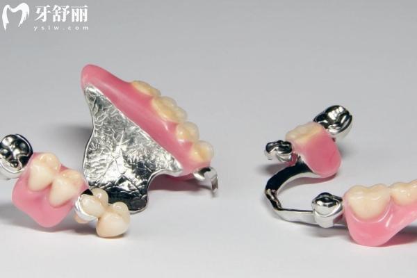 掉了一顆牙怎么鑲牙適合