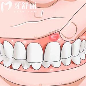 患有牙周疾病，脫發(fā)風(fēng)險(xiǎn)也會(huì)增加真的嗎？
