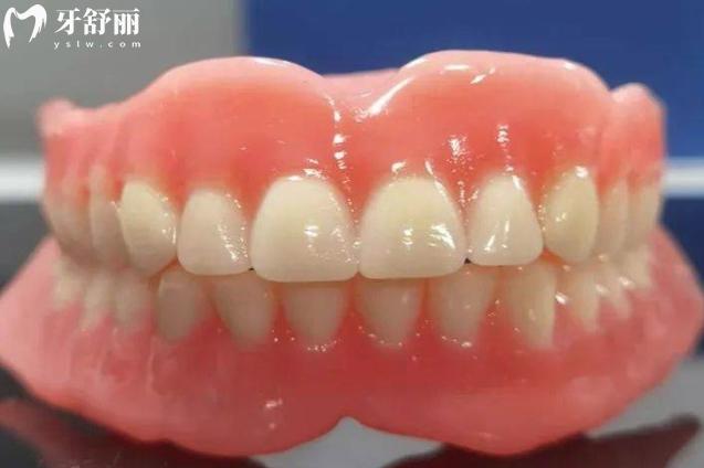 吸附性義齒的優(yōu)缺點(diǎn)