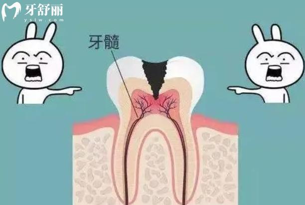 顯微根管治療的優(yōu)點和缺點