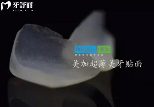 美加超薄瓷貼面