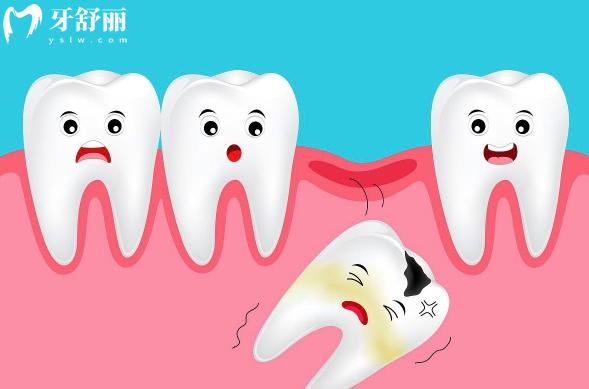 40歲缺牙導(dǎo)致后面牙齒傾斜怎么辦