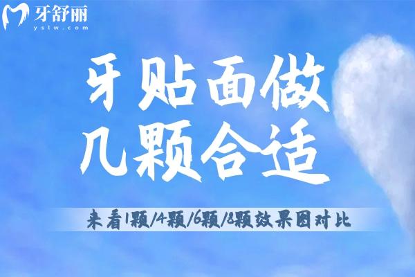 牙貼面做幾顆合適