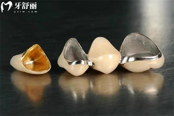 牙冠保質(zhì)期2年有問(wèn)題可以免費(fèi)換嗎?看看保質(zhì)期內(nèi)出現(xiàn)損壞怎么賠償?shù)?