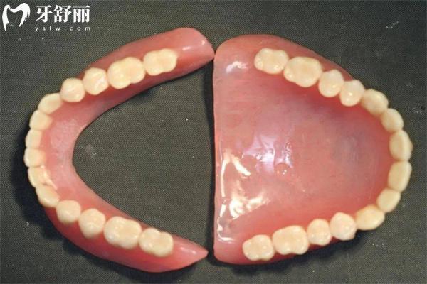 吸附性義齒需要什么條件才能戴?對比普通義齒有啥區(qū)別價格多少錢?