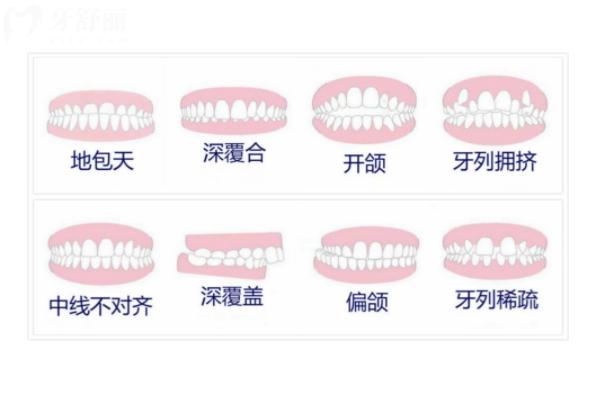 牙齒不整齊做烤瓷牙能變整齊嗎