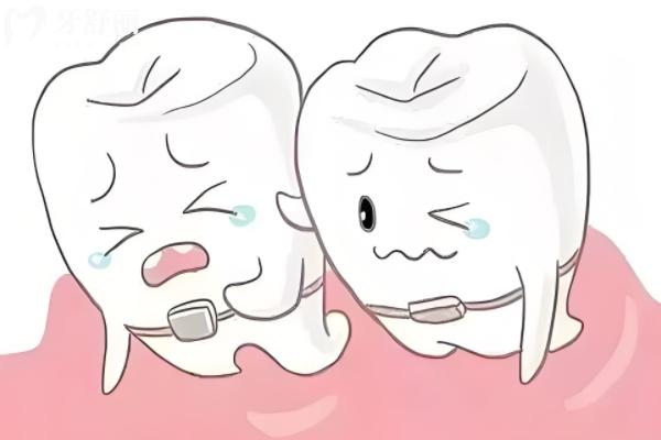 牙齒矯正后怎么更丑了