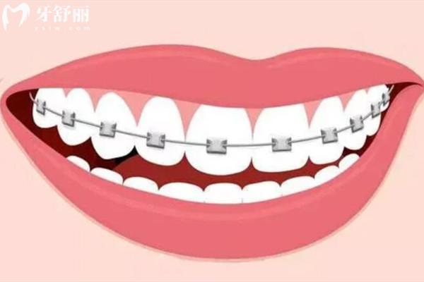 仁壽縣牙科醫(yī)院收費(fèi)標(biāo)準(zhǔn)