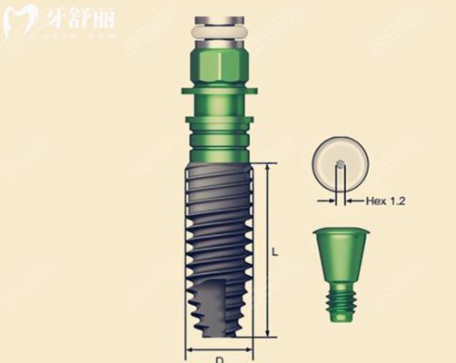 美國(guó)儒伽zuga種植體