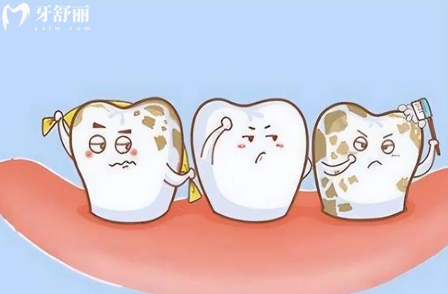 牙齒上有牙菌斑怎么去除