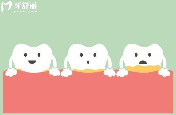 牙齒上有牙菌斑怎么去除