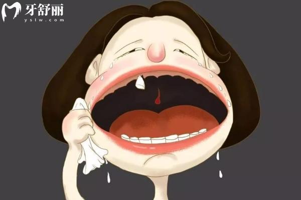 牙齒掉落