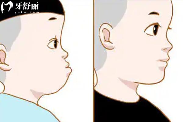 三歲幼兒遭遇地包天，家長如何應(yīng)對與治療？