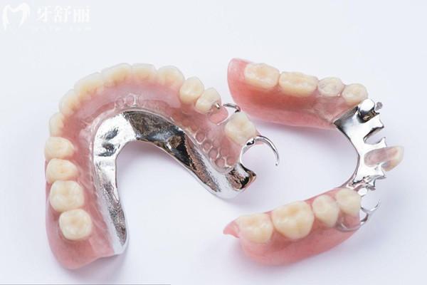 活動(dòng)假牙每天晚上都要取下來(lái)嗎