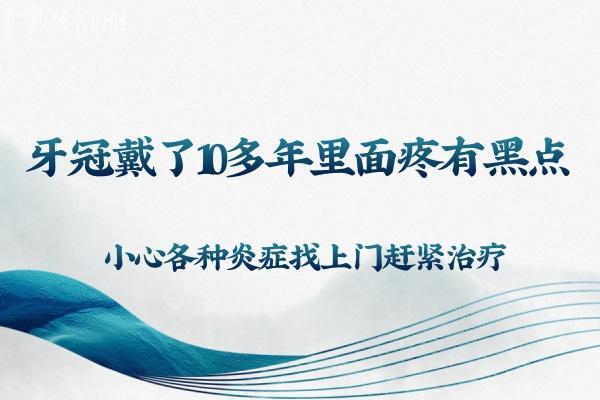 牙冠戴了10多年里面疼有黑點(diǎn)?小心各種炎癥找上門(mén)趕緊治療