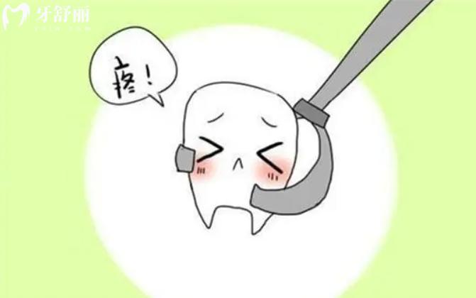 微創(chuàng)拔牙與普通拔牙的區(qū)別