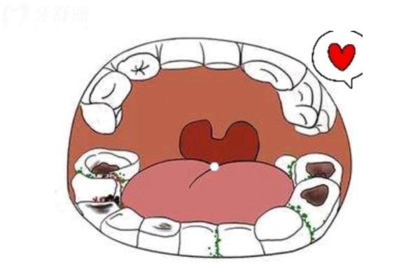 夢見牙齒一塊塊脫落是什么意思