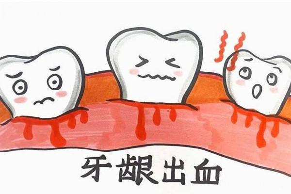 牙周病如何治療療效好