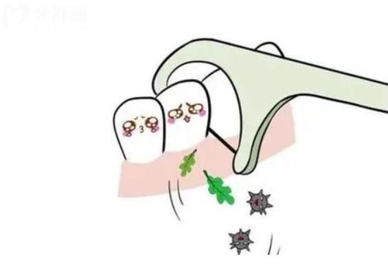 牙縫清潔有什么好處