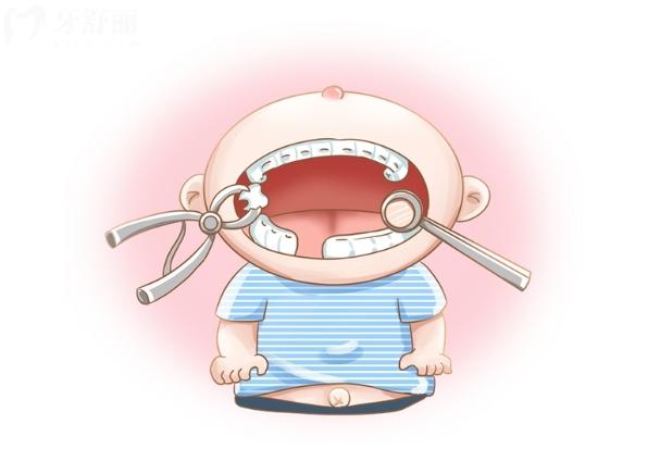 兒童拔牙需要打麻醉嗎