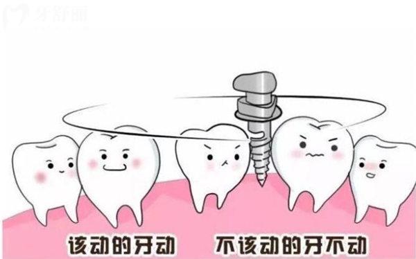 正畸打骨釘與不打骨釘?shù)膮^(qū)別有哪些