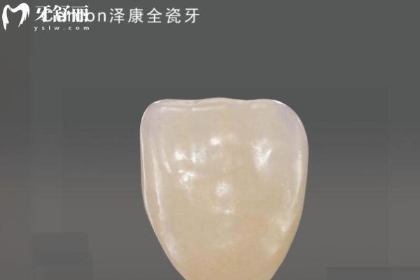 800元的全瓷牙能用嗎？