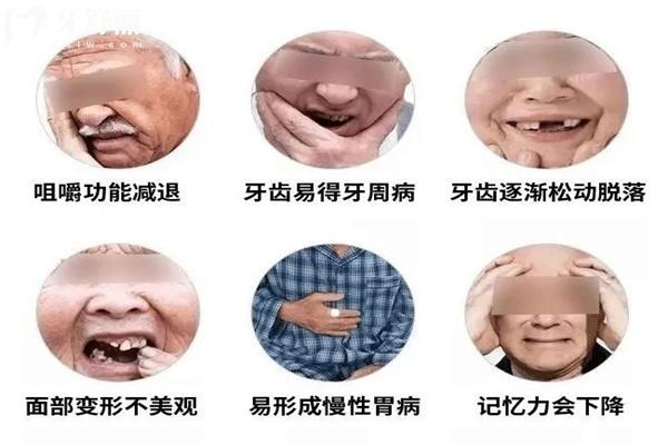 老人牙床萎縮還能安裝假牙嗎