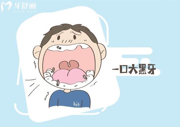 齲齒