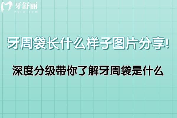 牙周袋長什么樣子圖片分享!深度分級帶你了解牙周袋是什么?