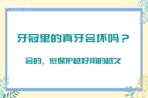 牙冠里的真牙會壞嗎？會的，但保護越好用的越久