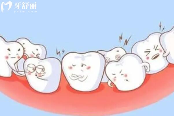 雙排牙齒要拔掉嗎?什么時(shí)候拔好？
