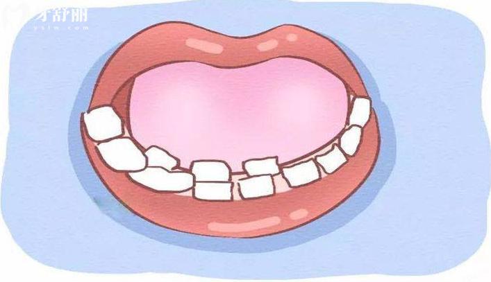 雙排牙齒要拔掉嗎?什么時(shí)候拔好？