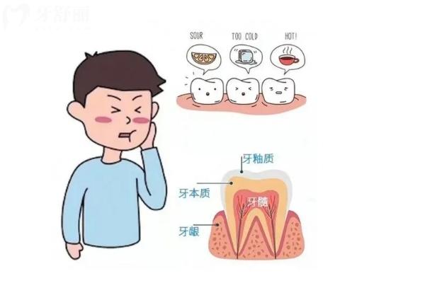 牙神經(jīng)為什么會外露？癥狀＋治療＋預(yù)防一文了解