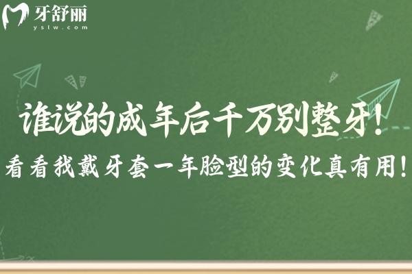 誰(shuí)說(shuō)的成年后千萬(wàn)別整牙!看看我戴牙套一年臉型的變化真有用!