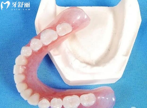 什么叫德國無掛鉤舒適鑲牙,附優(yōu)缺點價格參考下