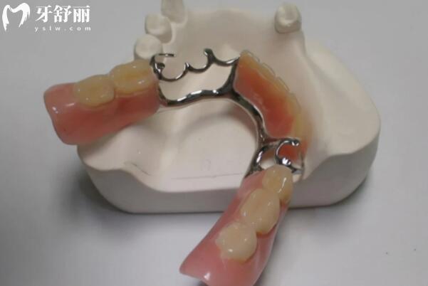 假牙種類繁多,如何挑選耐用且美觀?忽略這一點(diǎn),可能損失更多牙齒