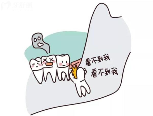 拔智齒發(fā)炎是什么癥狀