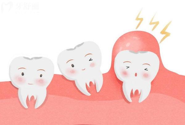 發(fā)炎的智齒為什么不能拔